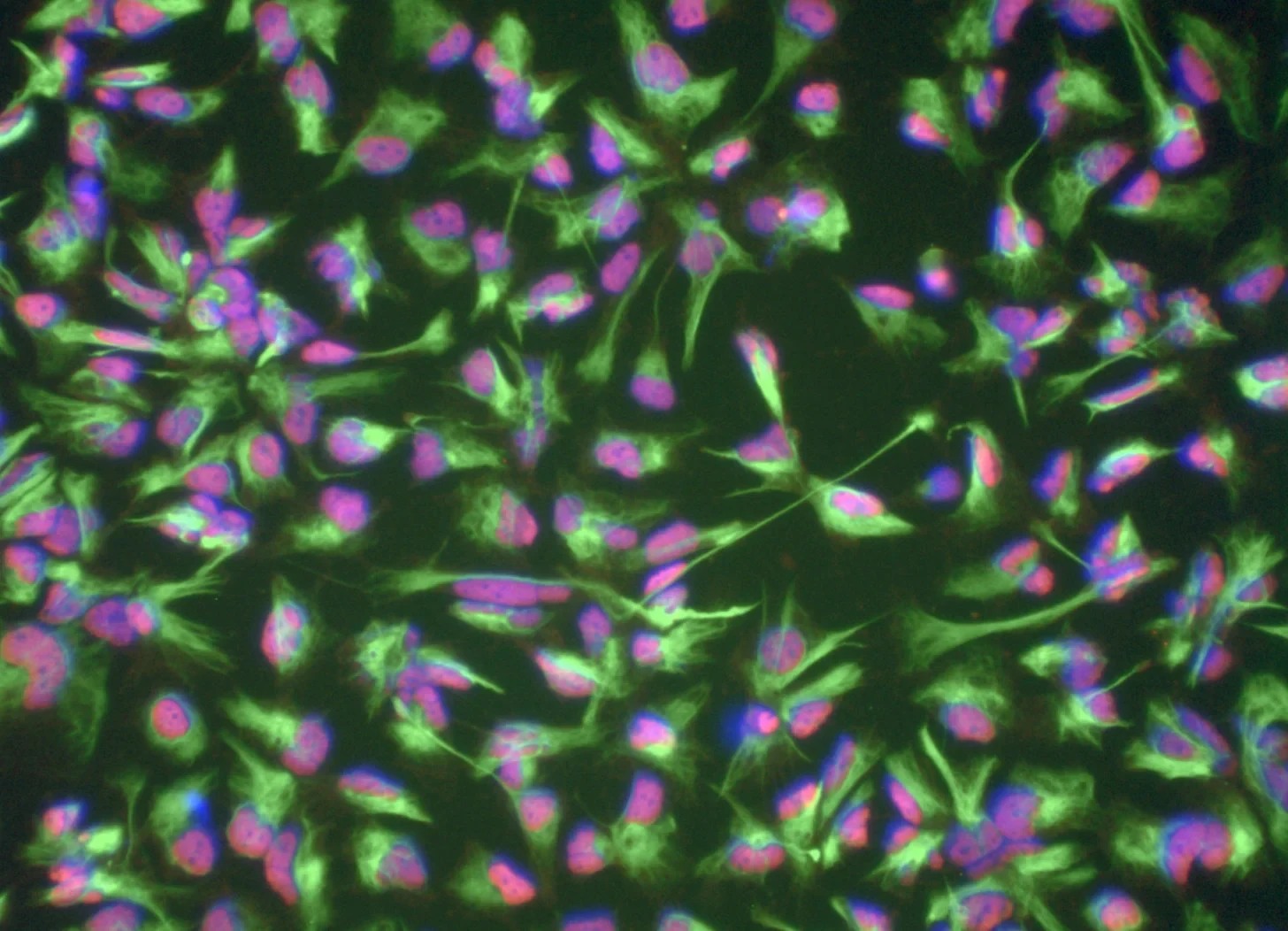 Induced neural stem cells derived from blood cells of a 101-year-old donor. This supplied image is not the specific 80-year-old example discussed in the report.