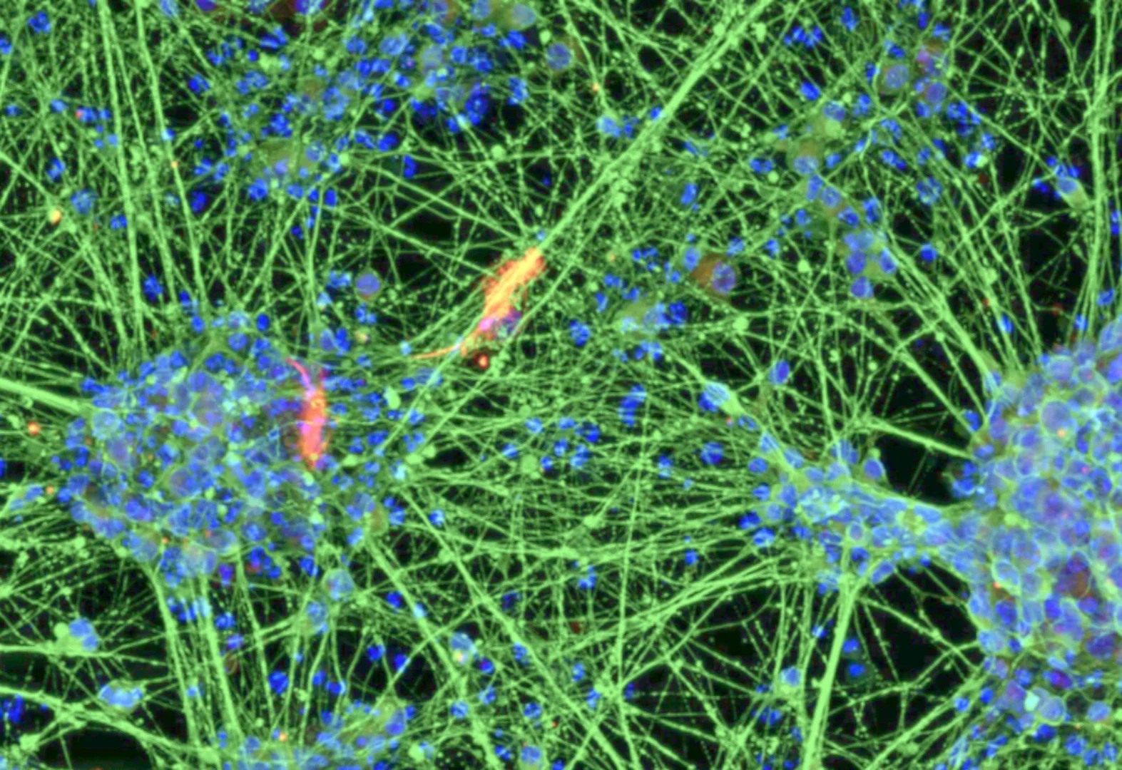 Neurons generated by differentiating induced neural stem cells derived from blood. Research microscopy supplied by the University of Bonn.